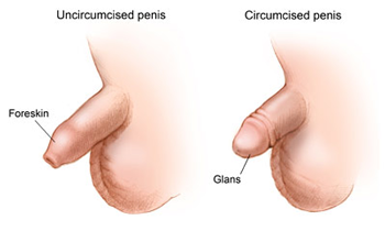 uncircumcised & circumcised penis